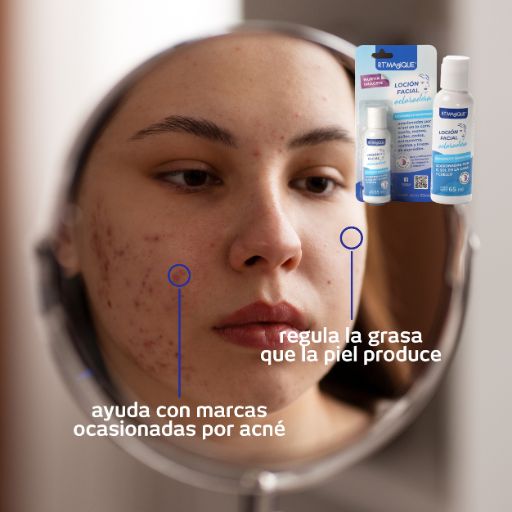 Belleza Natural con la Loción Aclaradora